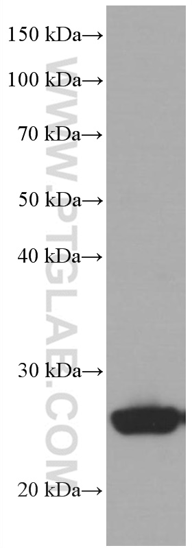 WB analysis of human adipose using 66700-1-Ig