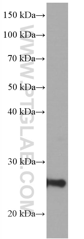 WB analysis of human skeletal muscle using 66700-1-Ig