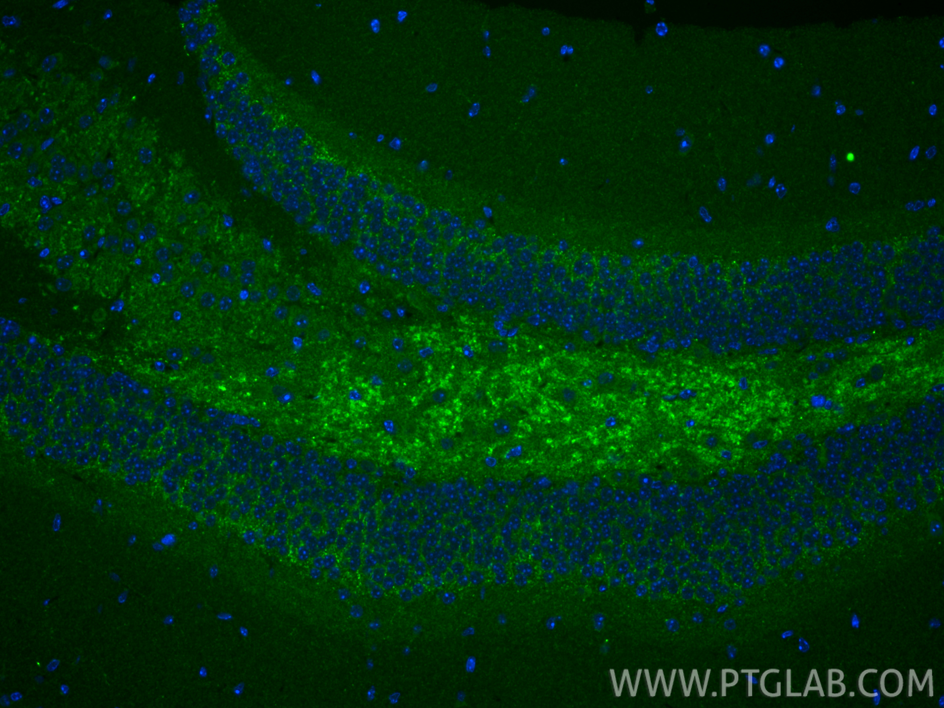 IF Staining of mouse brain using 10750-1-AP IF Staining of mouse brain using 10750-1-AP