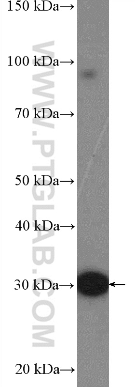 UCP3 Polyclonal antibody