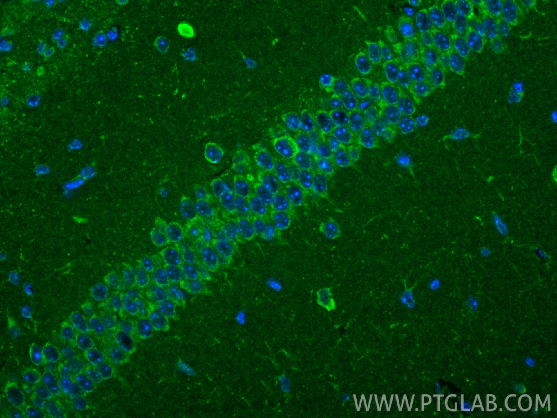 IF Staining of mouse brain using 25223-1-AP IF Staining of mouse brain using 25223-1-AP