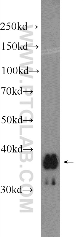 UCP5 Polyclonal antibody