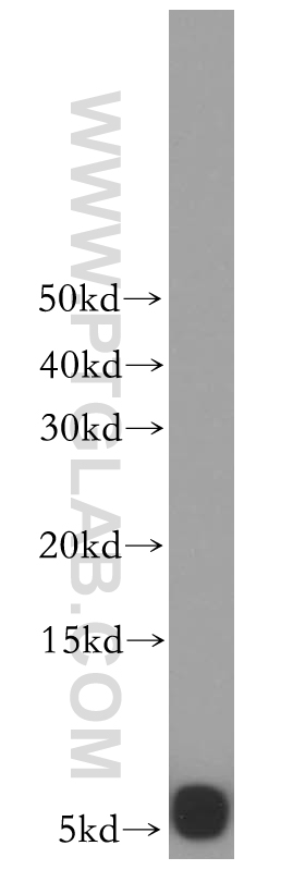 WB analysis of human heart using 17779-1-AP