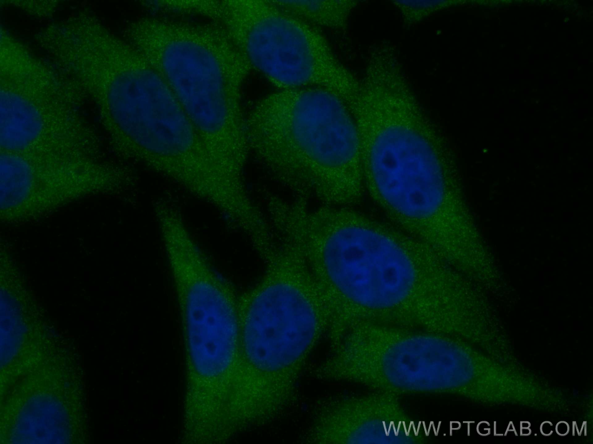 IF Staining of HepG2 using 10615-1-AP