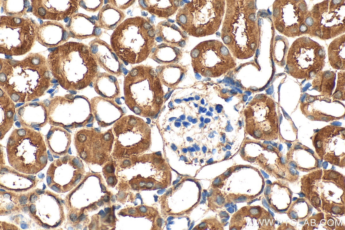 Immunohistochemical analysis of paraffin-embedded mouse kidney tissue slide using 10615-1-AP (UFD1L antibody) at dilution of 1:200 (under 40x lens). Heat mediated antigen retrieval with Tris-EDTA buffer (pH 9.0). IHC staining of mouse kidney using 10615-1-AP