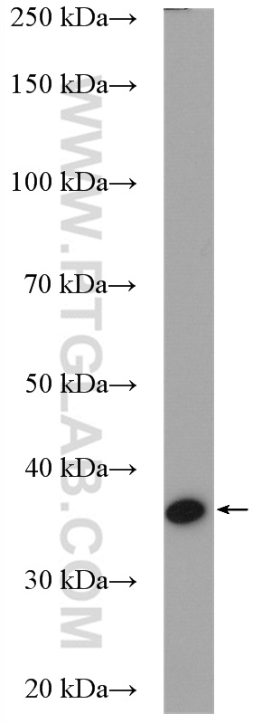 WB analysis of K-562 using 10615-1-AP