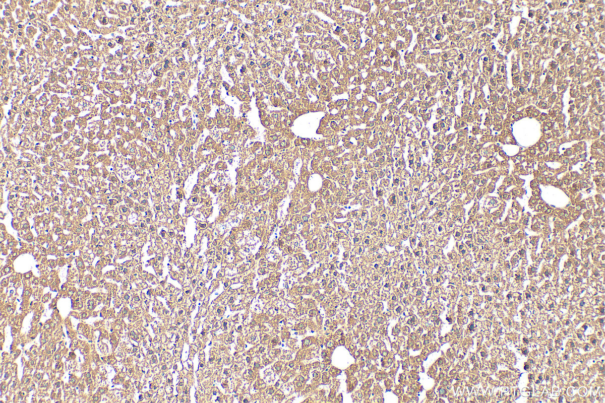 IHC staining of mouse liver using 16999-1-AP