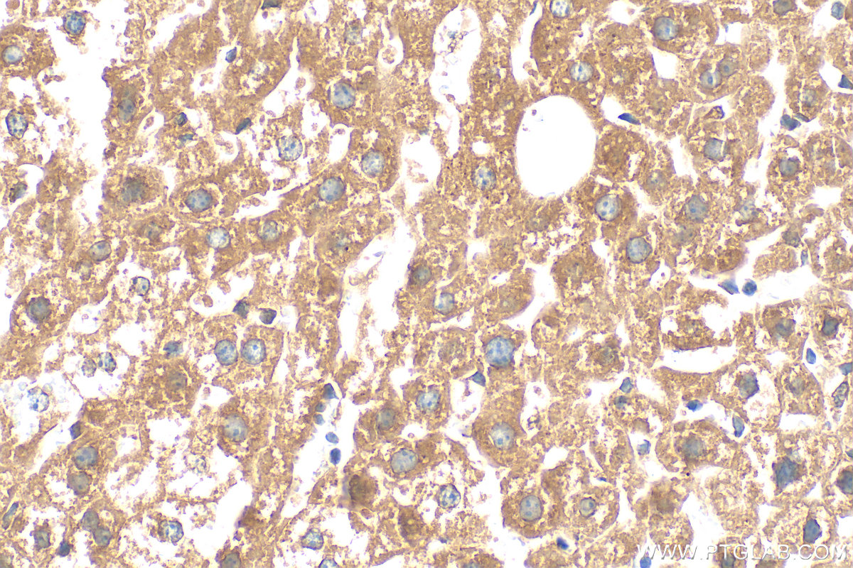 IHC staining of mouse liver using 16999-1-AP
