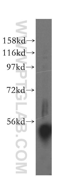 WB analysis of mouse pancreas using 16999-1-AP