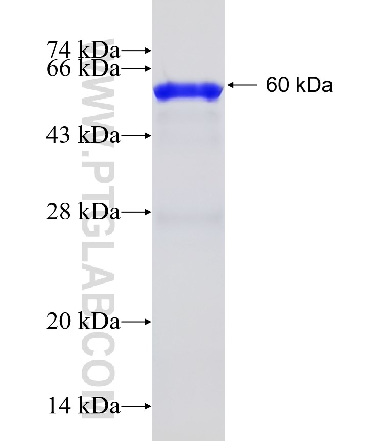 UGCGL1 fusion protein Ag5369 SDS-PAGE