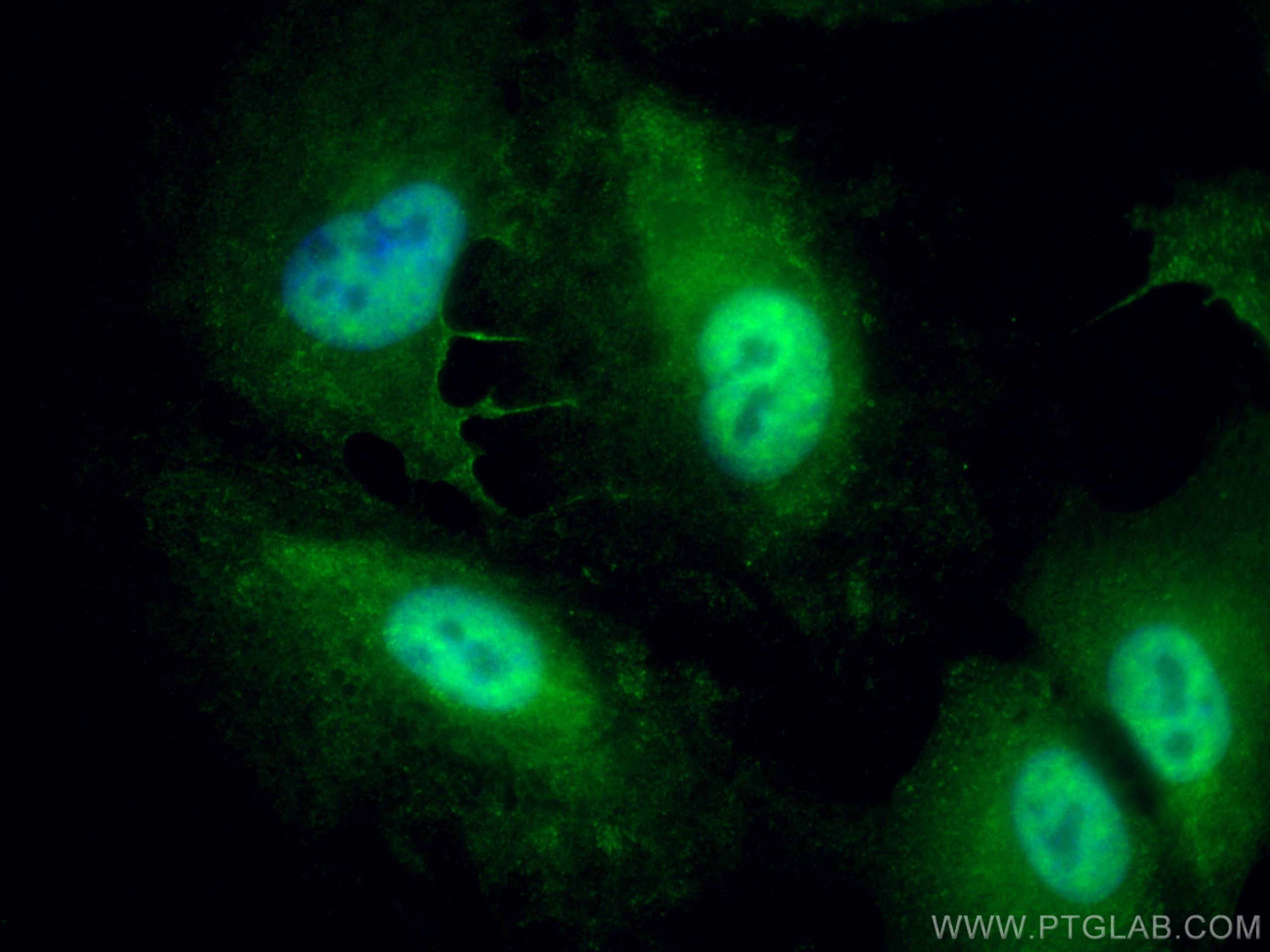 IF Staining of A549 using 13151-1-AP