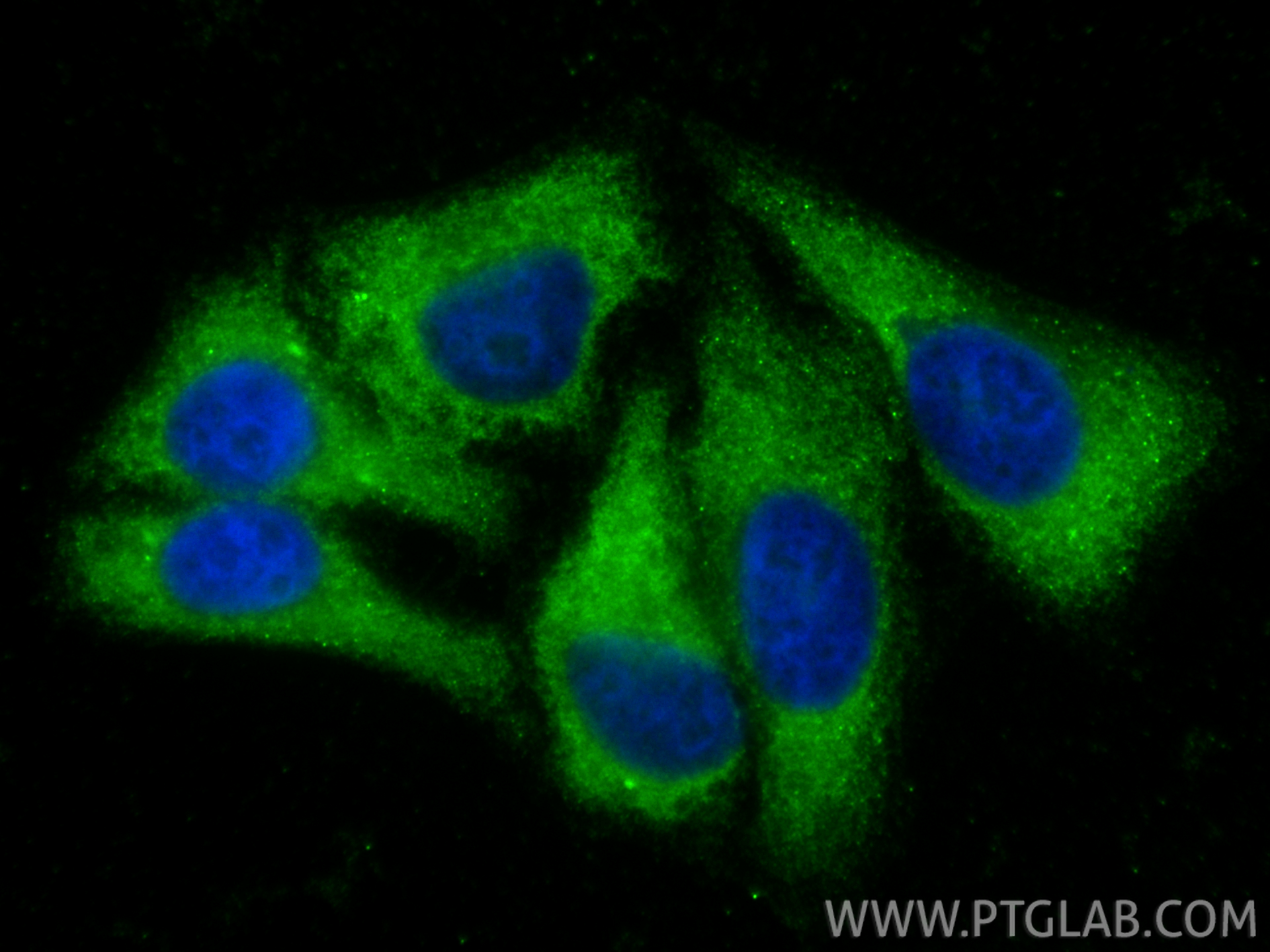 IF Staining of HepG2 using 10391-1-AP