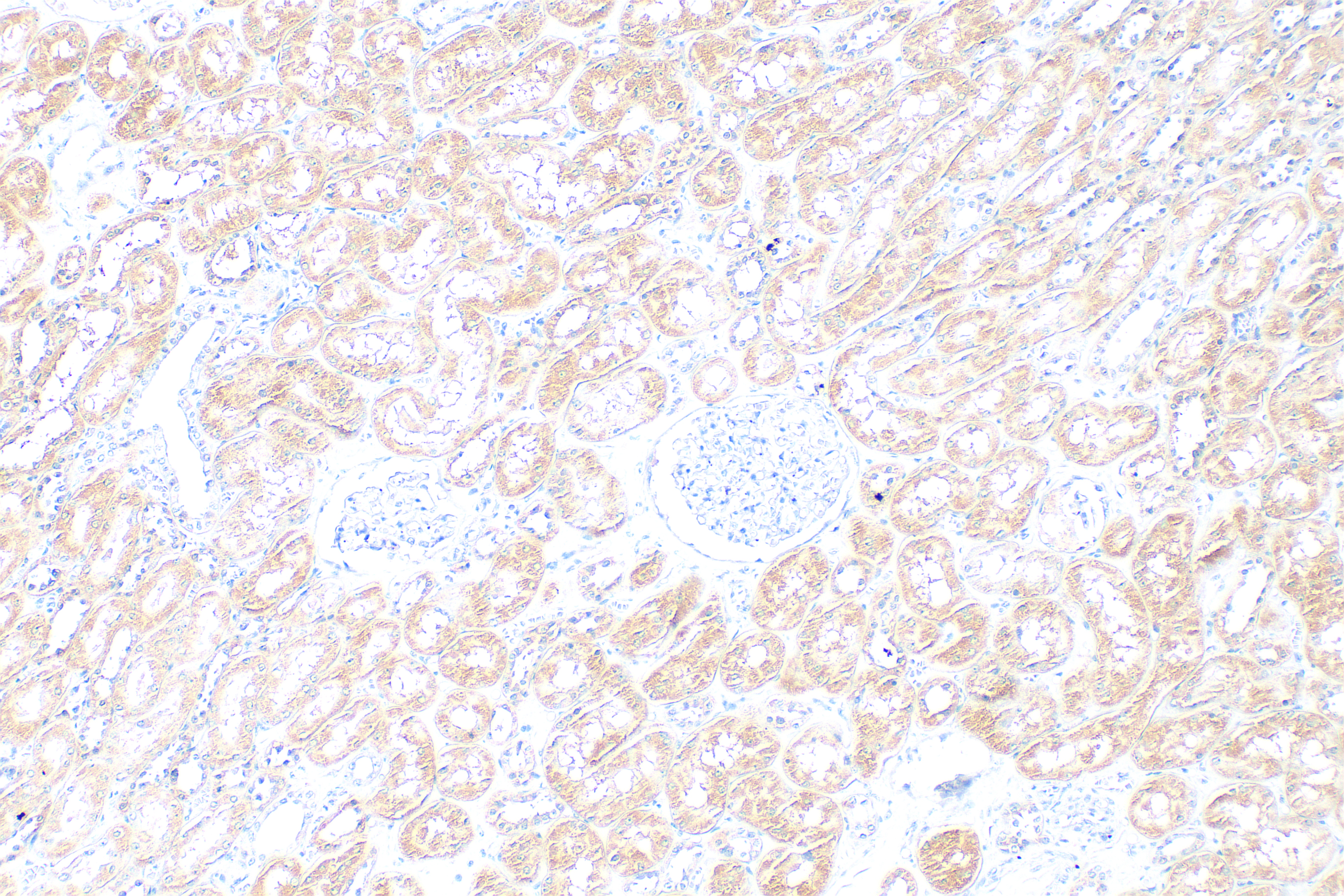IHC staining of human kidney using 10391-1-AP