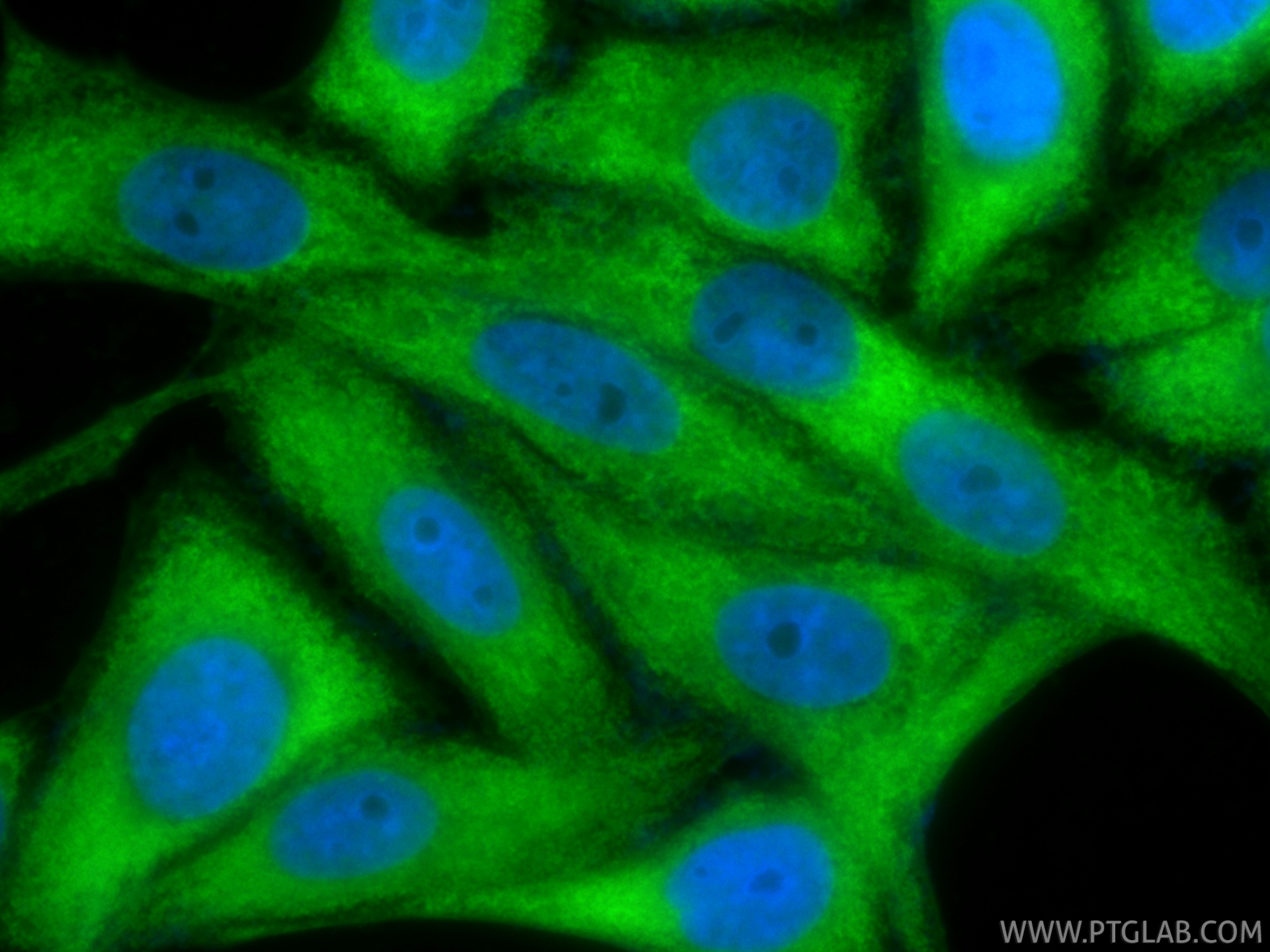 IF Staining of HepG2 using CL488-86699 IF Staining of HepG2 using CL488-86699