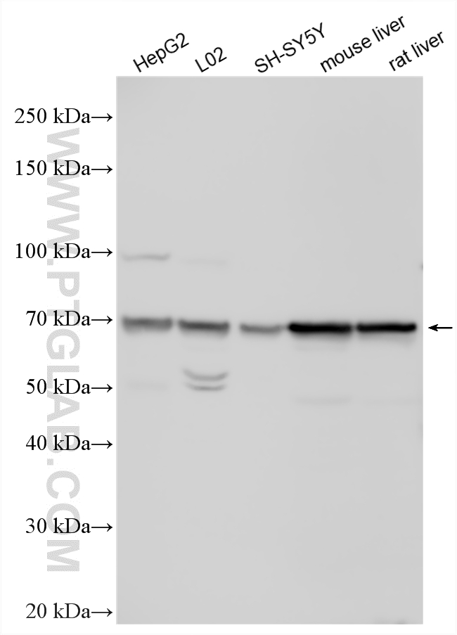 Various lysates were subjected to SDS PAGE followed by western blot with 23495-1-AP (UGT1A1 antibody) at dilution of 1:1000 incubated at room temperature for 1.5 hours. WB analysis using 23495-1-AP