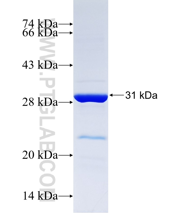UGT2B10 fusion protein Ag37373 SDS-PAGE UGT2B10 fusion protein Ag37373 SDS-PAGE