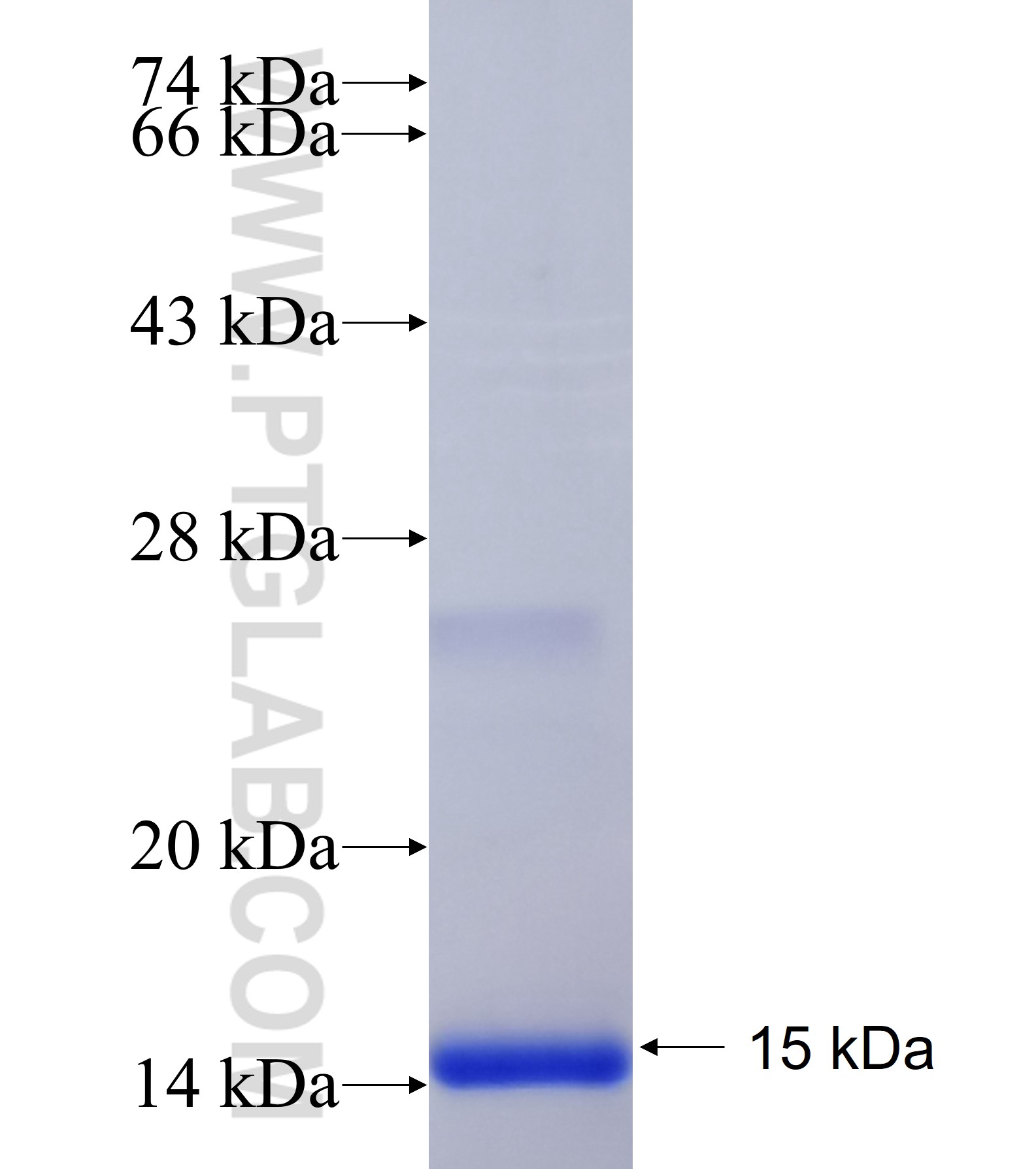 UGT2B11 fusion protein Ag40865 SDS-PAGE UGT2B11 fusion protein Ag40865 SDS-PAGE