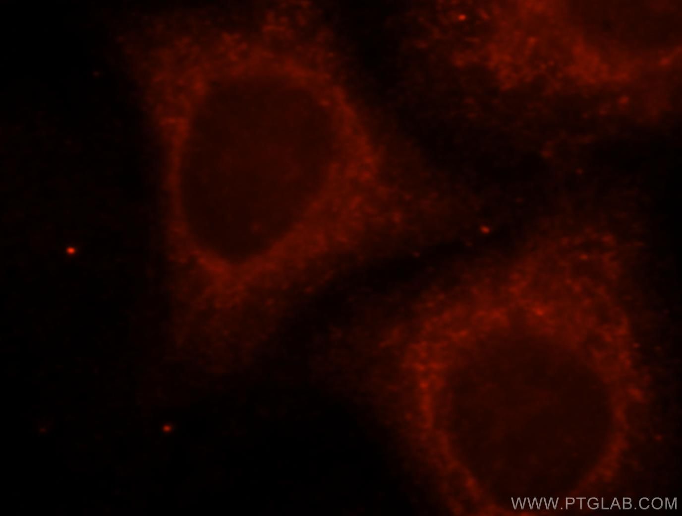 IF Staining of HepG2 using 15425-1-AP