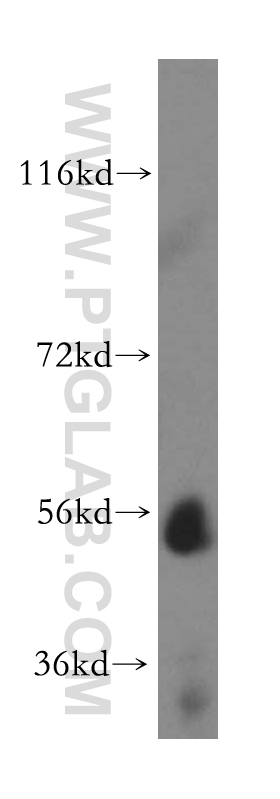 WB analysis of human liver using 15425-1-AP