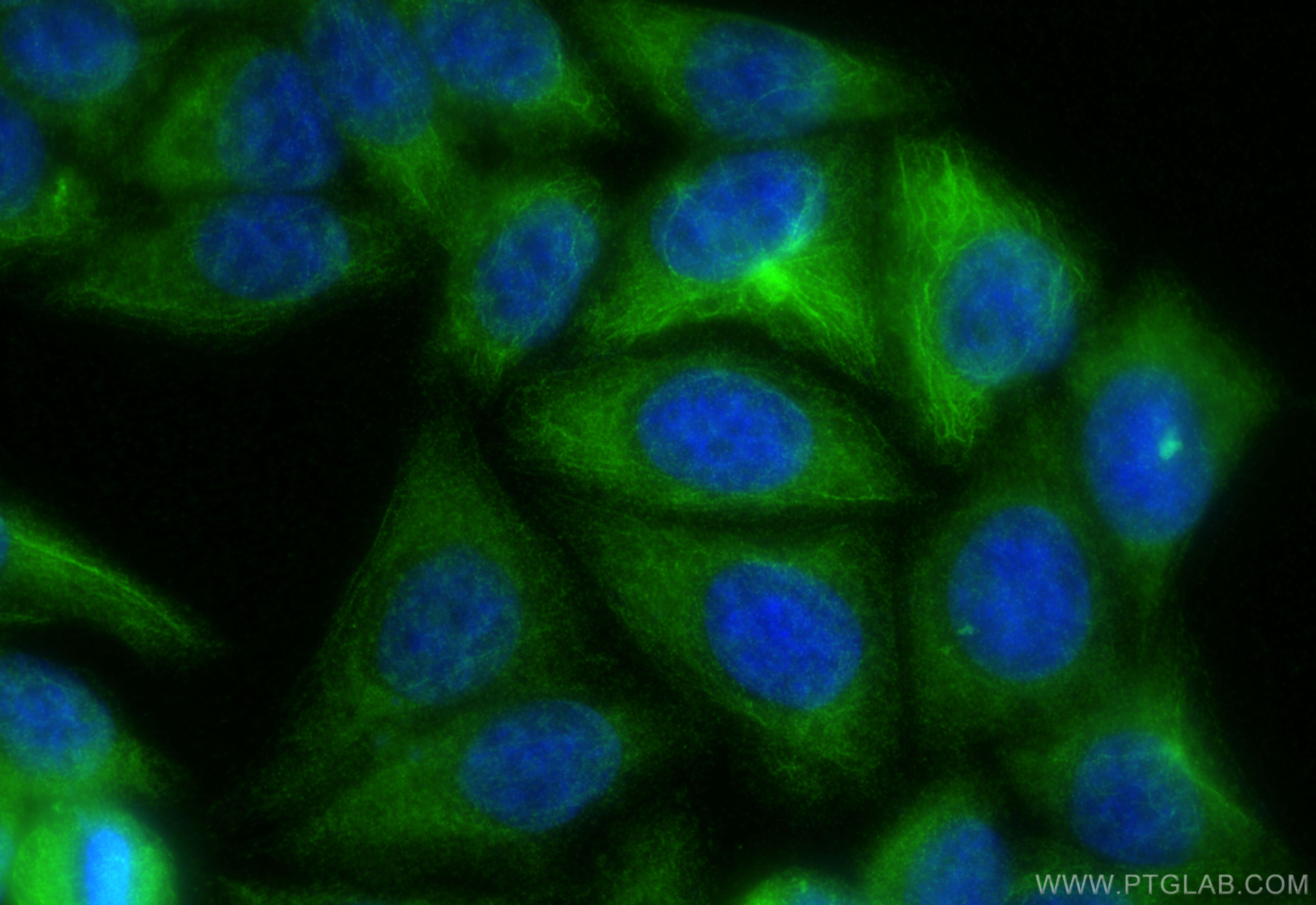 IF Staining of HepG2 using 16661-1-AP