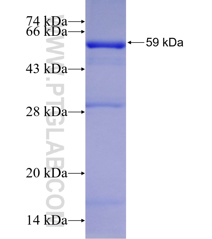 UGT2B7 fusion protein Ag10121 SDS-PAGE