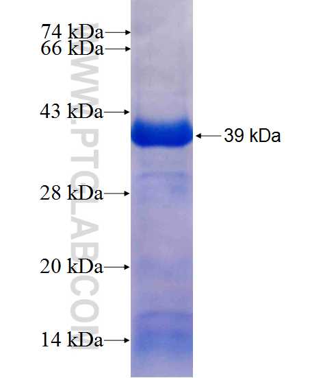 UGT2B7 fusion protein Ag10122 SDS-PAGE UGT2B7 fusion protein Ag10122 SDS-PAGE