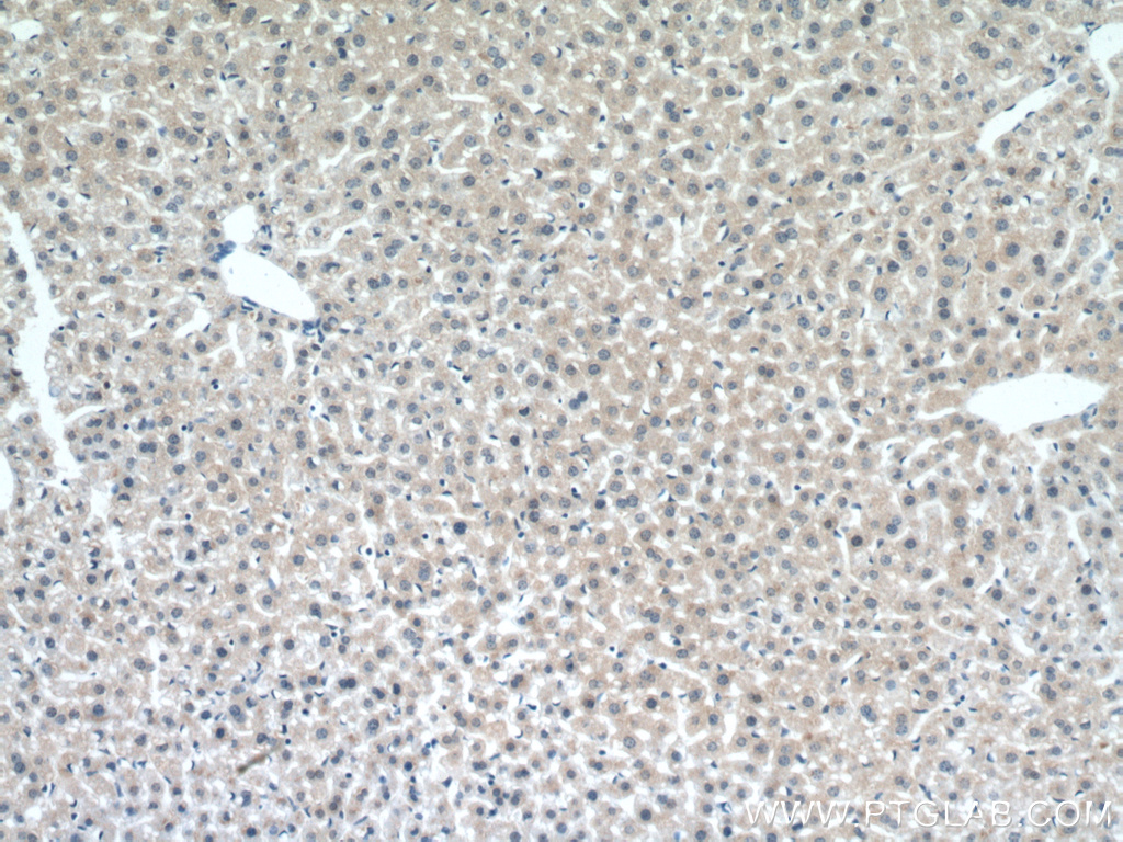 IHC staining of mouse liver using 21366-1-AP