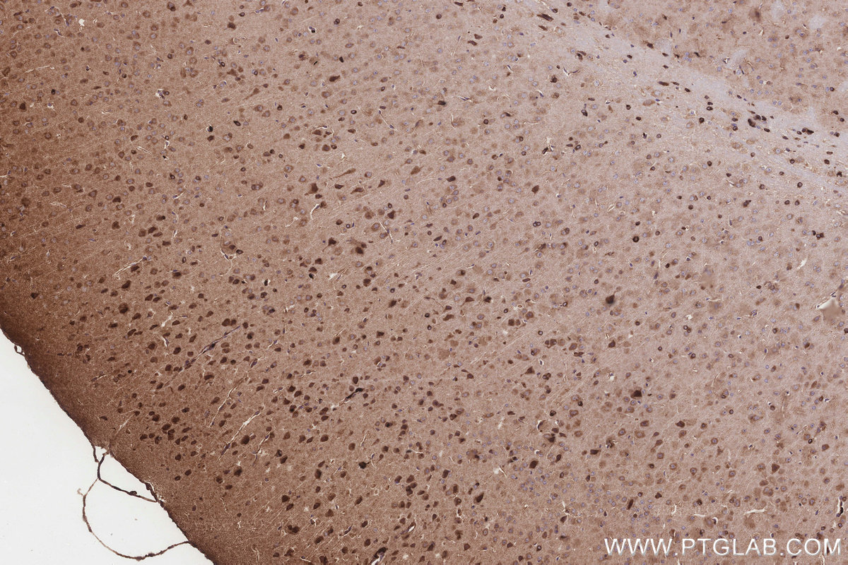 IHC staining of mouse brain using 17982-1-AP IHC staining of mouse brain using 17982-1-AP