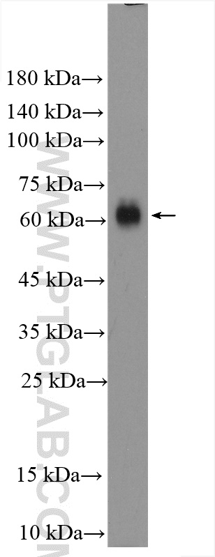 WB analysis of rat brain using 17982-1-AP
