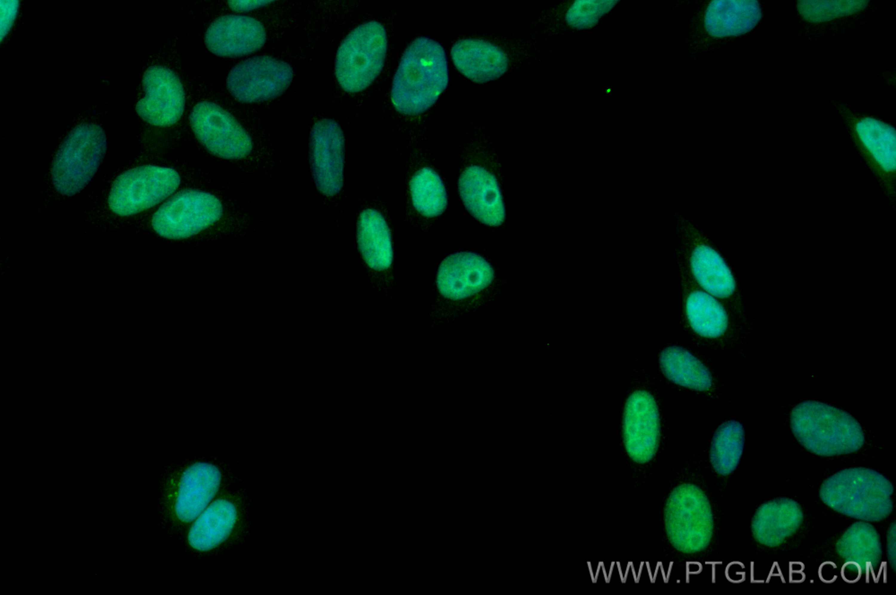 IF Staining of HepG2 using 21402-1-AP