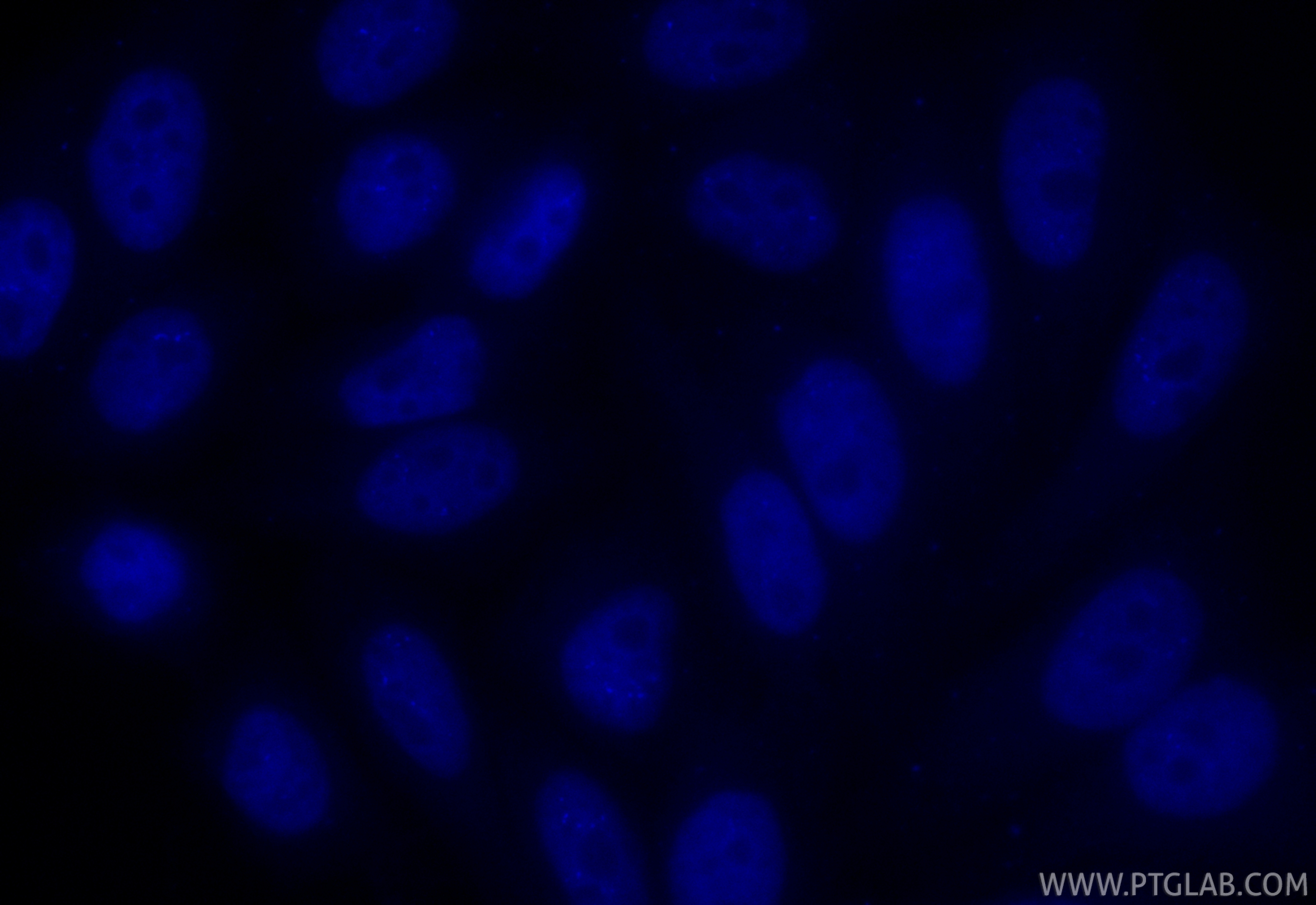 IF Staining of HepG2 using CL405-84489-4