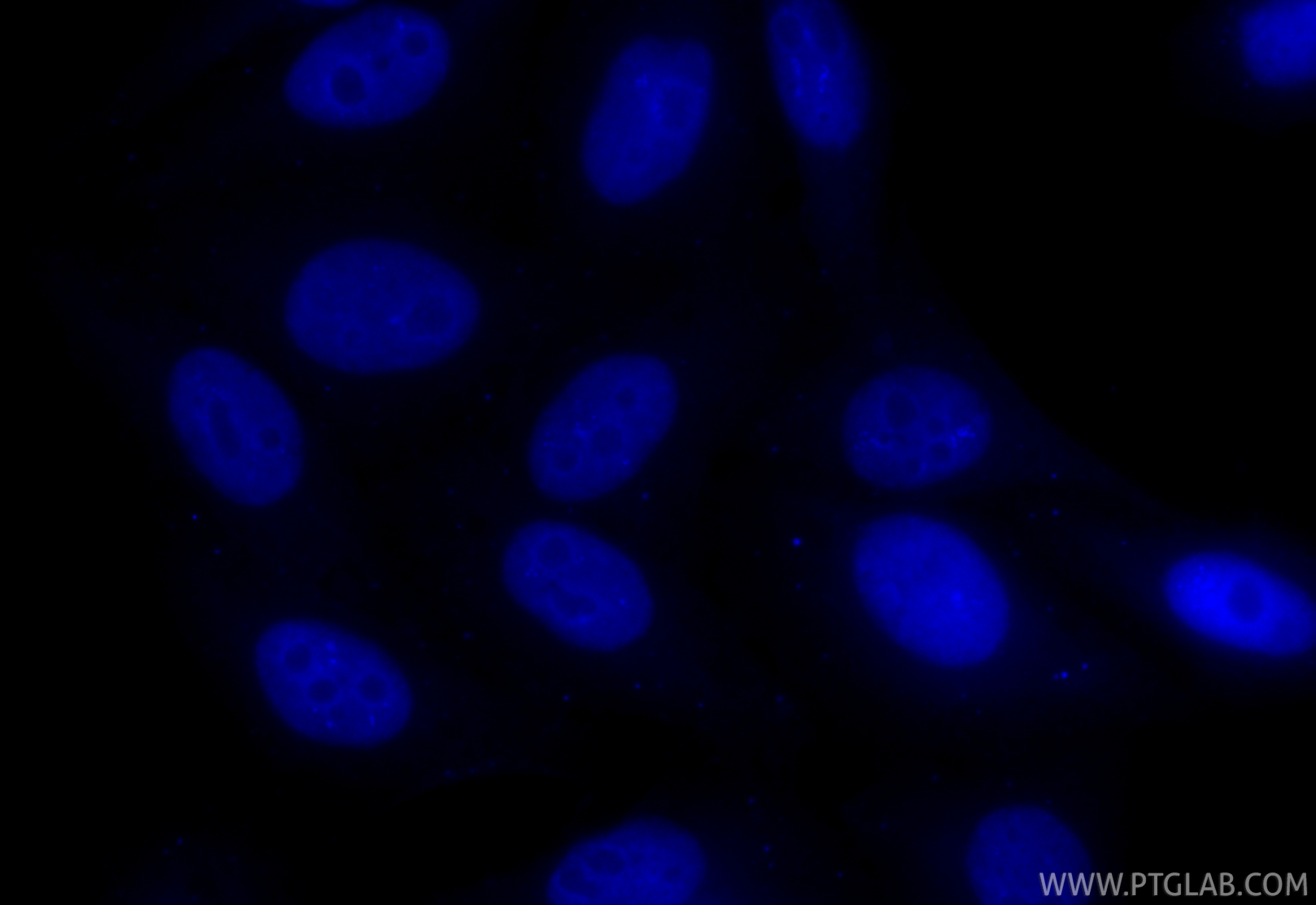 IF Staining of HepG2 using CL405-84489-5