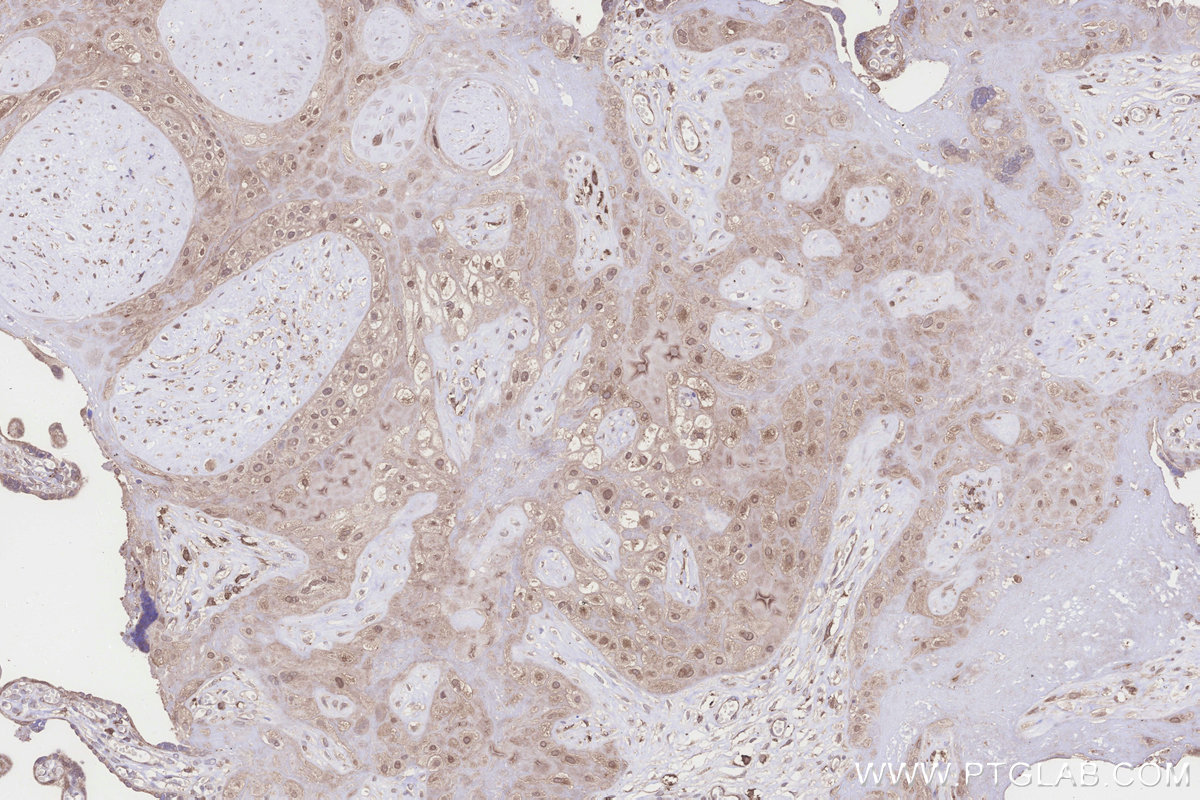 IHC staining of human placenta using 24345-1-AP IHC staining of human placenta using 24345-1-AP