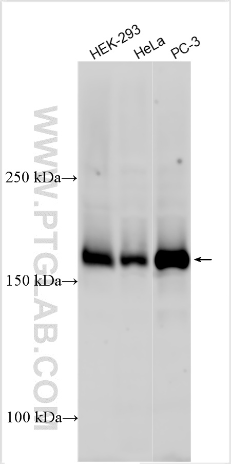 WB analysis using 24345-1-AP WB analysis using 24345-1-AP