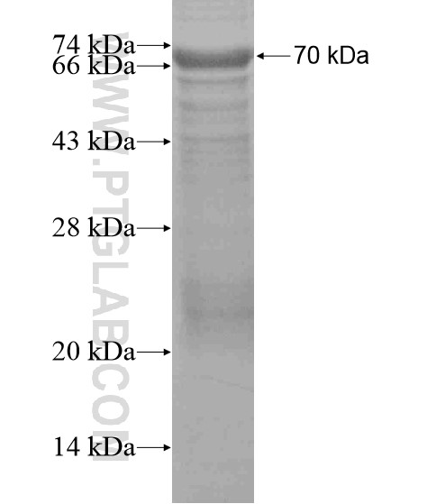 UHRF1BP1 fusion protein Ag19677 SDS-PAGE UHRF1BP1 fusion protein Ag19677 SDS-PAGE