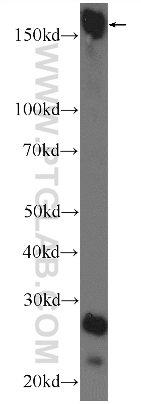 WB analysis of mouse brain using 25121-1-AP