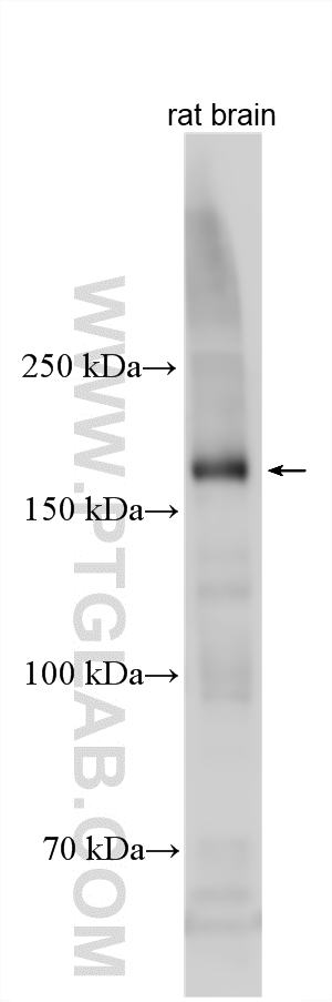 WB analysis using 25121-1-AP