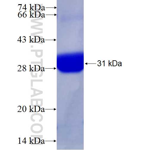 UHRF2 fusion protein Ag22519 SDS-PAGE
