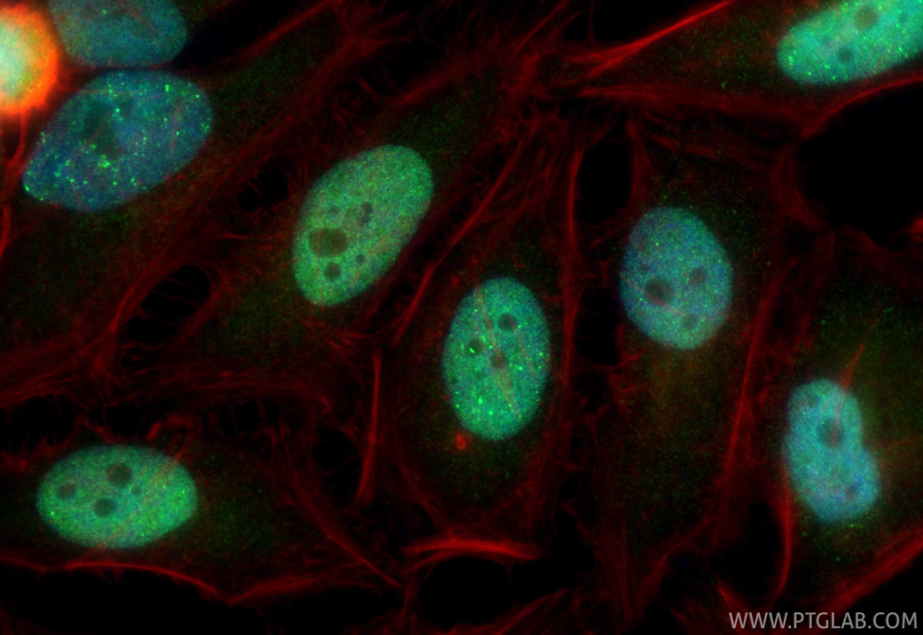 IF Staining of HeLa using 13642-1-AP IF Staining of HeLa using 13642-1-AP