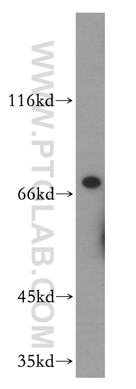 WB analysis of mouse colon using 13642-1-AP