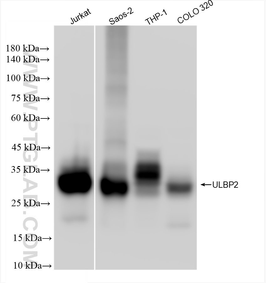 WB analysis using 83709-1-RR (same clone as 83709-1-PBS)