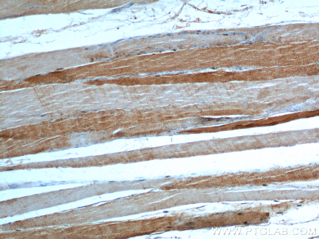 IHC staining of human skeletal muscle using 20986-1-AP