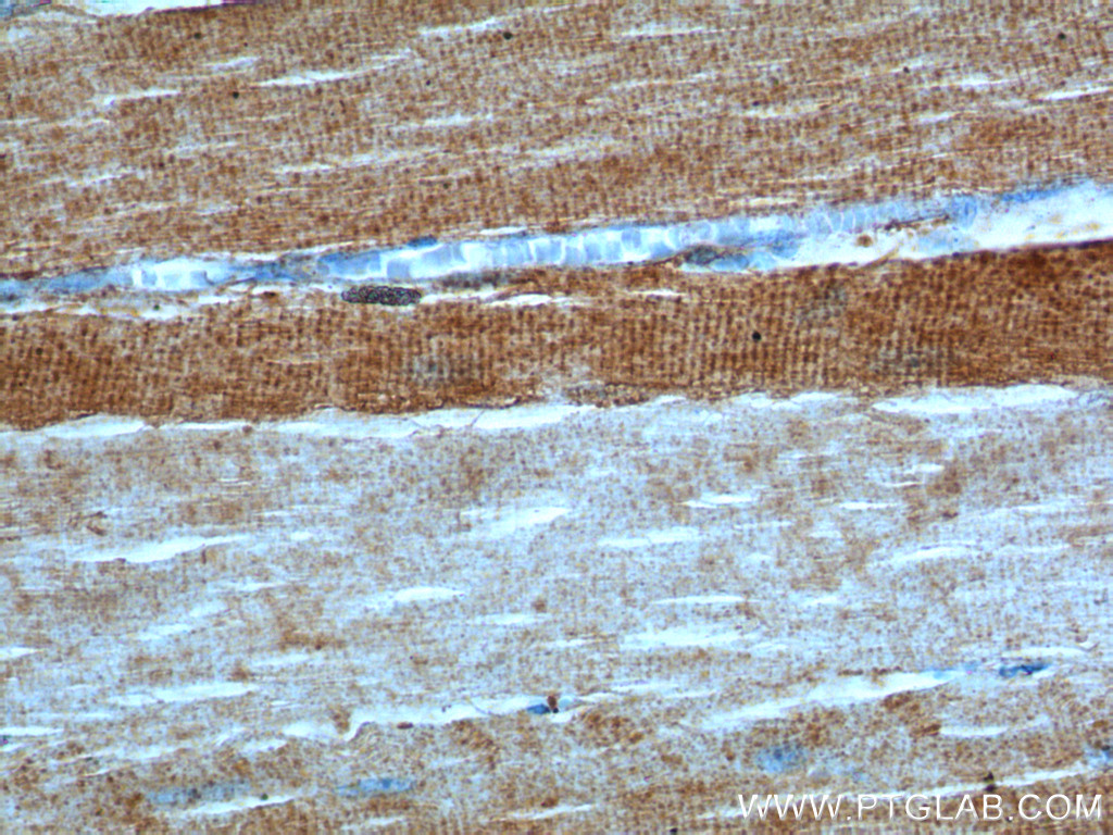 IHC staining of human skeletal muscle using 20986-1-AP