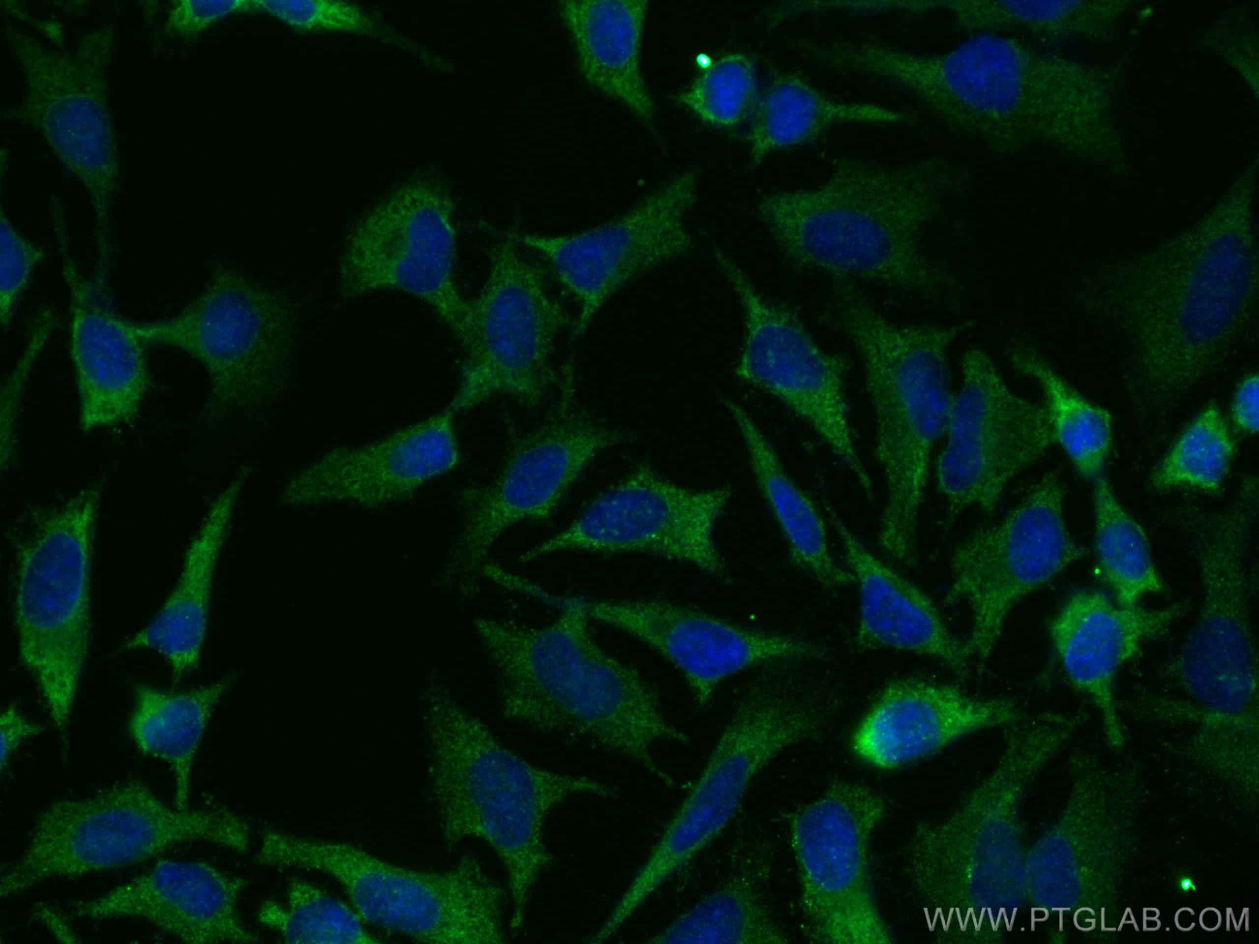 IF Staining of HeLa using 29005-1-AP