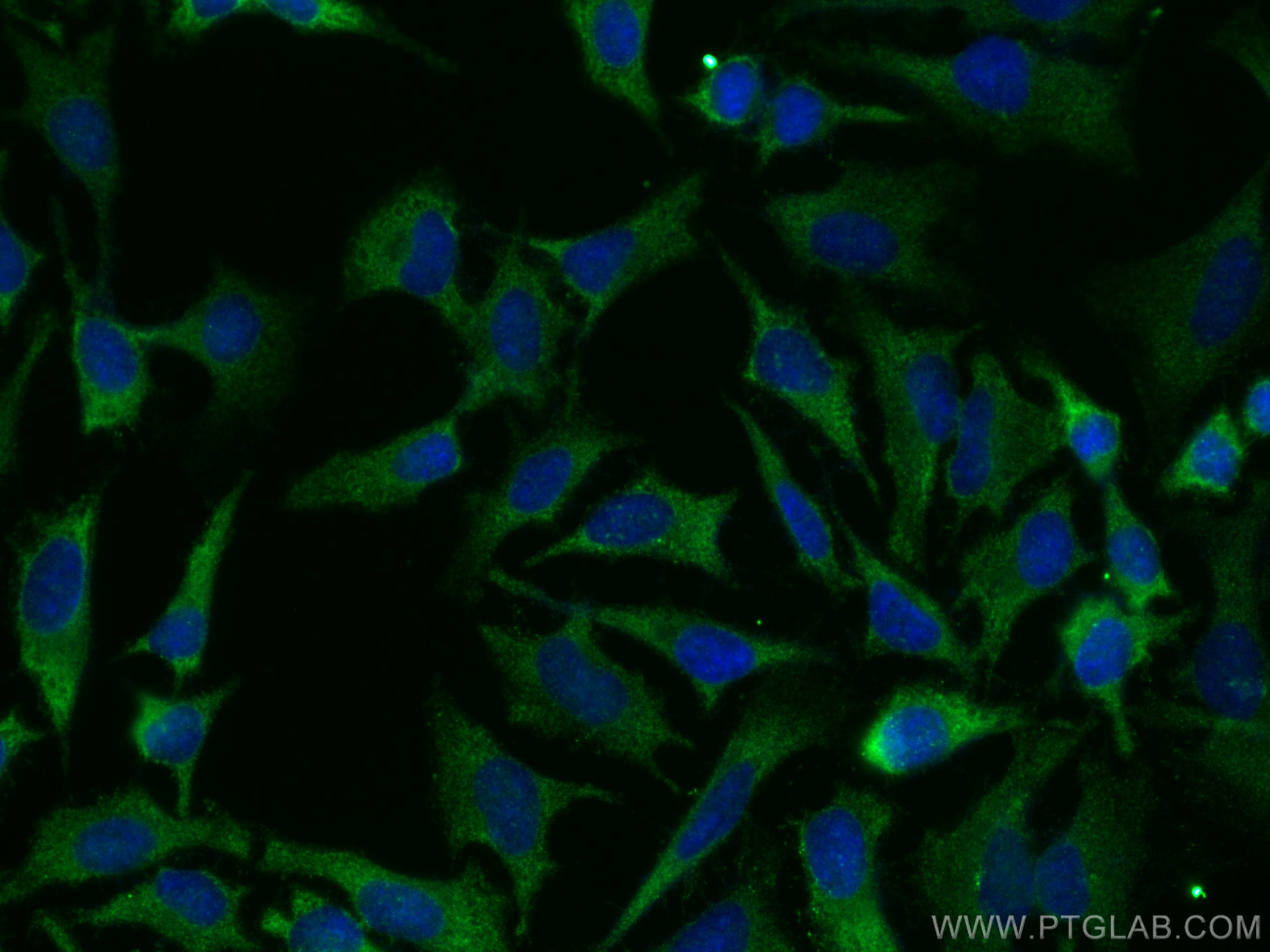 IF Staining of HeLa using 29005-1-AP