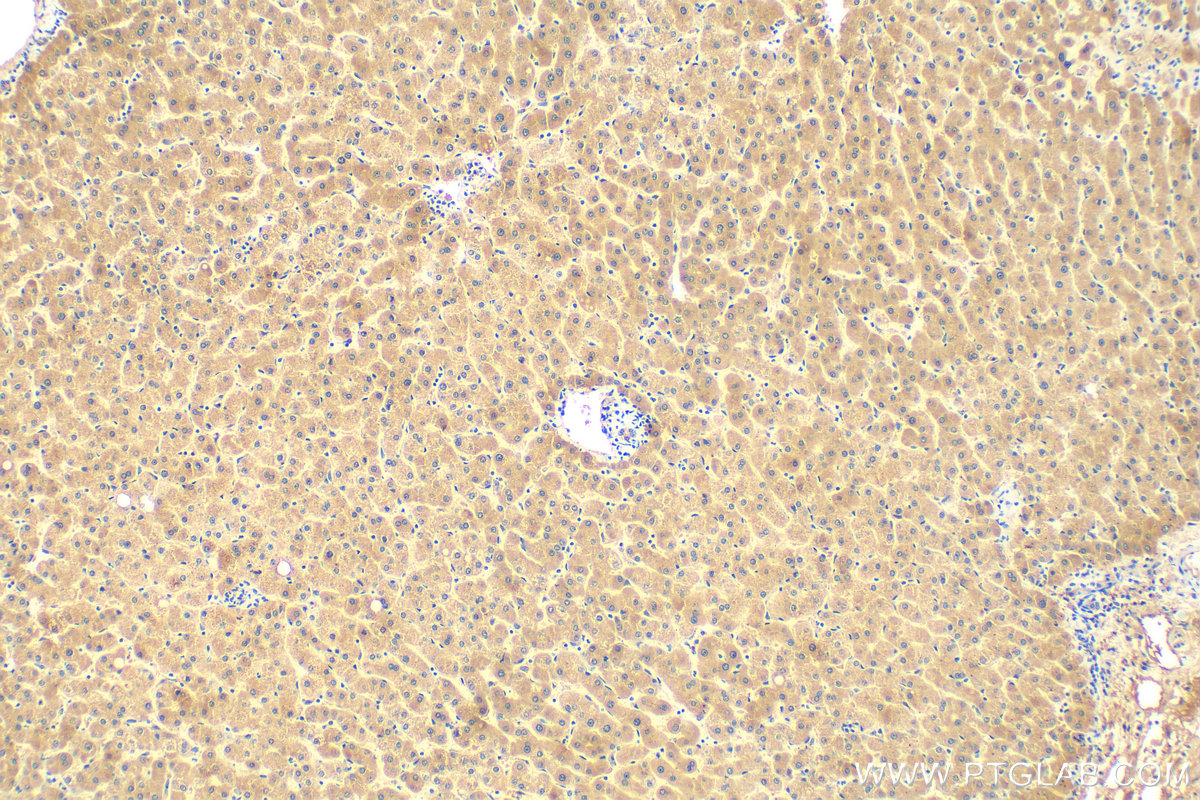 IHC staining of human liver using 68445-1-Ig