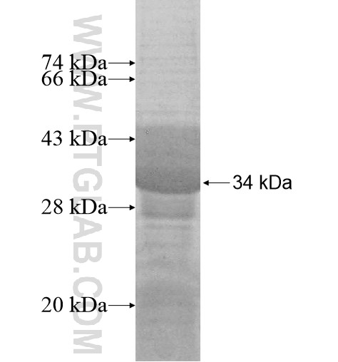 ULK2 fusion protein Ag14604 SDS-PAGE ULK2 fusion protein Ag14604 SDS-PAGE