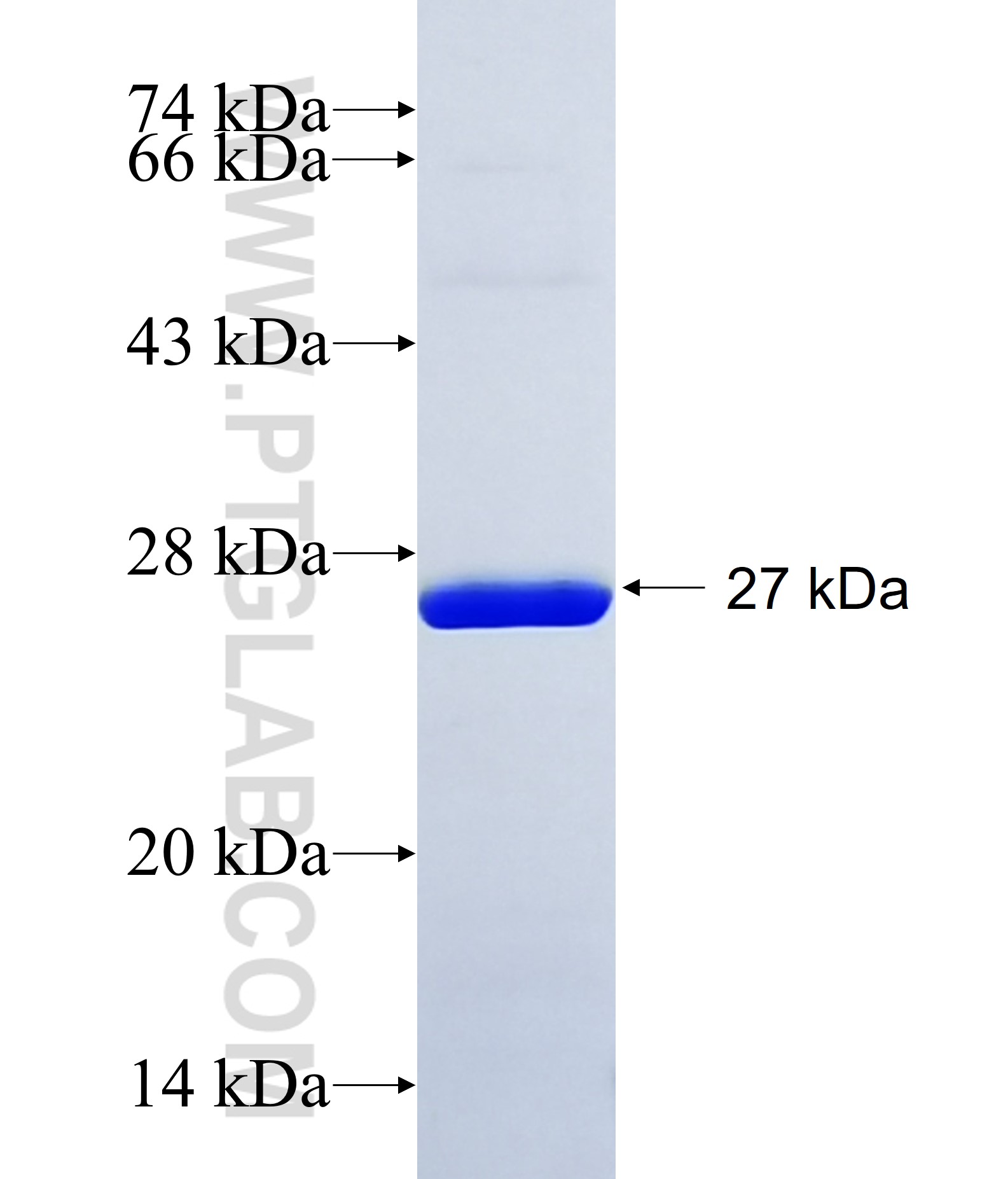 ULK3 fusion protein Ag15094 SDS-PAGE ULK3 fusion protein Ag15094 SDS-PAGE
