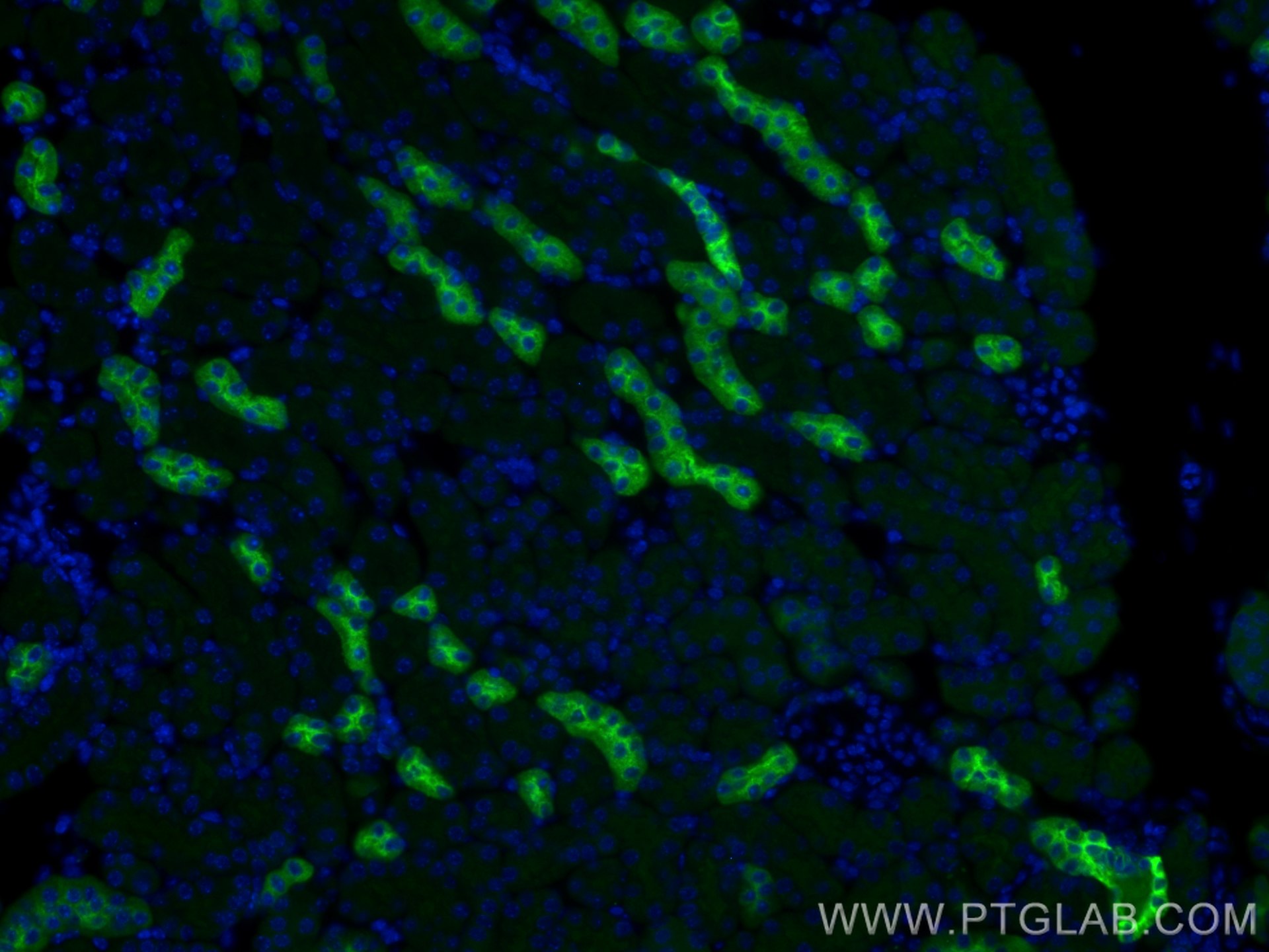 IF Staining of mouse kidney using 29975-1-AP (same clone as 29975-1-PBS)