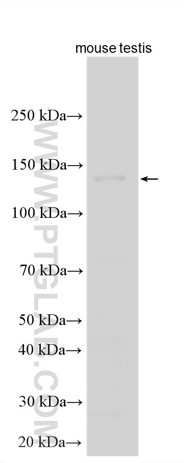 WB analysis using 31666-1-AP